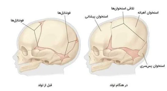فاصله پوست سر تا جمجمه
