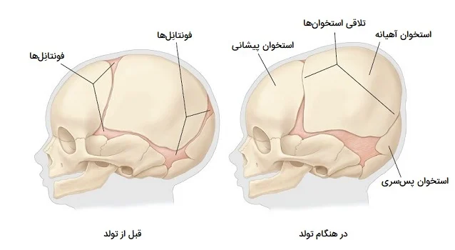 فاصله پوست سر تا جمجمه