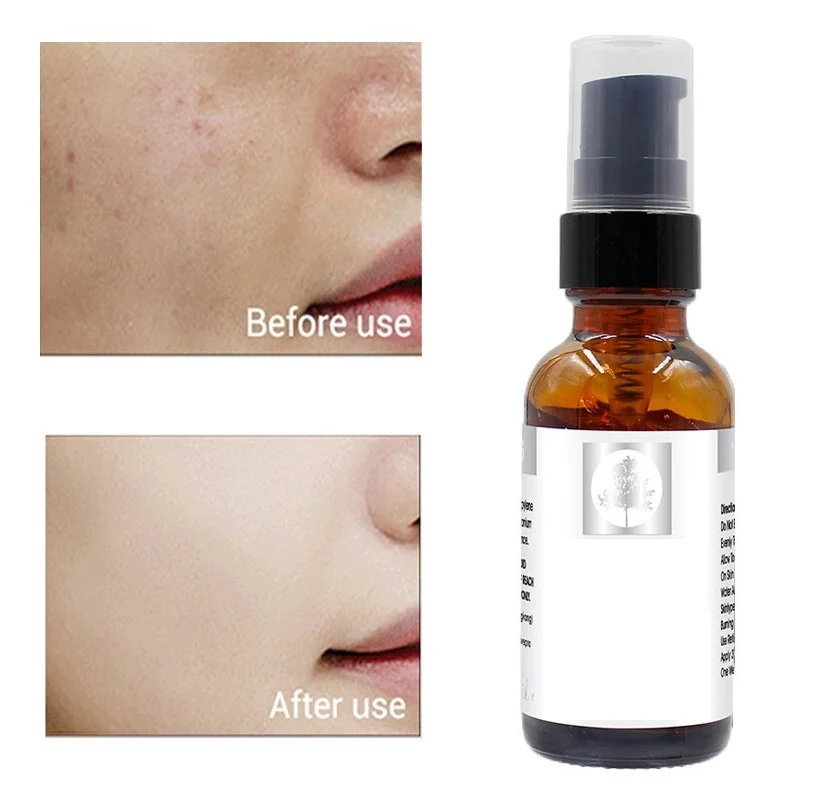 گلیکولیک اسید در صنایع آرایشی و بهداشتی؛ چرا این ماده محبوب است؟