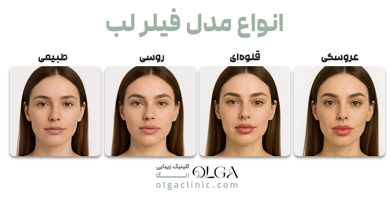 انواع مدل فیلر لب
